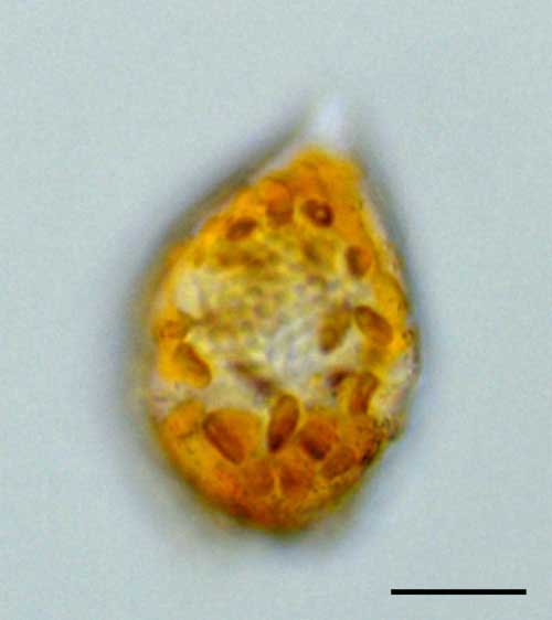 マルスズオビムシ（Scrippsiella trochoidea)の画像