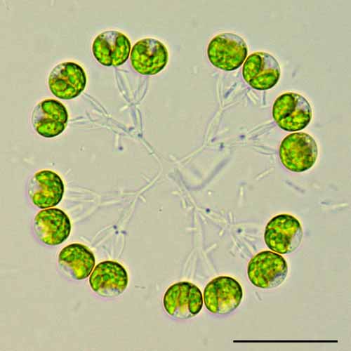 ディクチオスフェリウム（Dictyosphaerium sp.） の画像