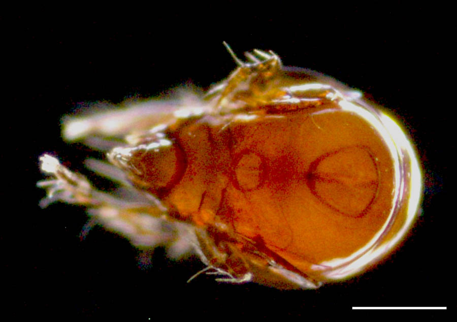 オトヒメダニ科(Scheloribatidae)の画像