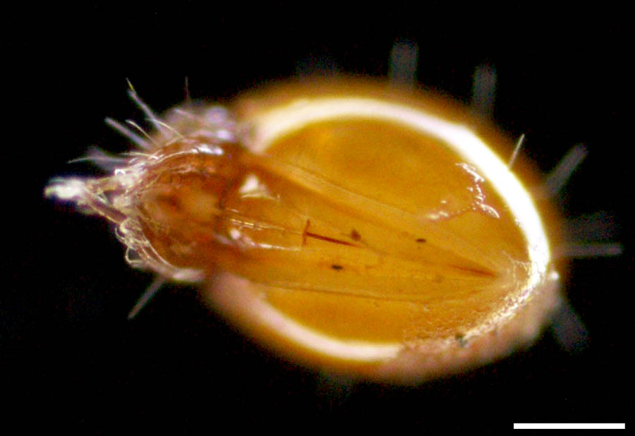 タテイレコダニ科(Oribotritiidae)の画像