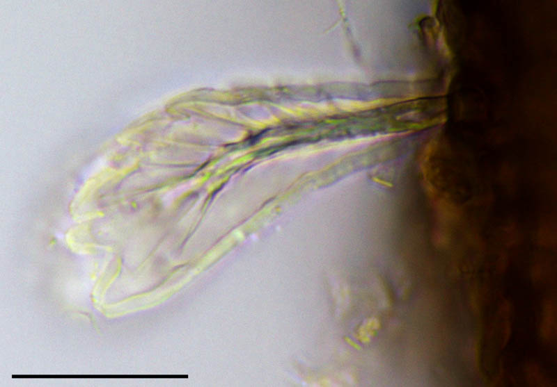 エゾアミメオニダニ (Nothrus ezoensis)の画像集
