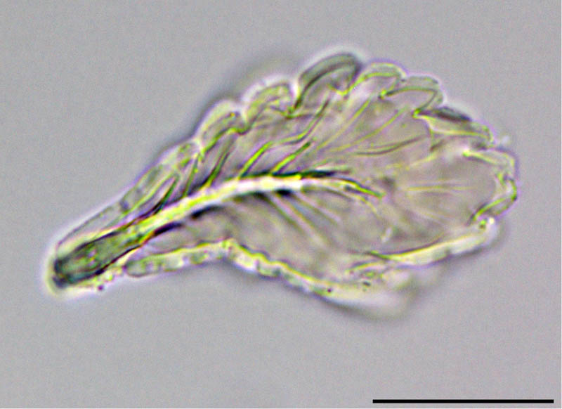 エゾアミメオニダニ (Nothrus ezoensis)の画像集