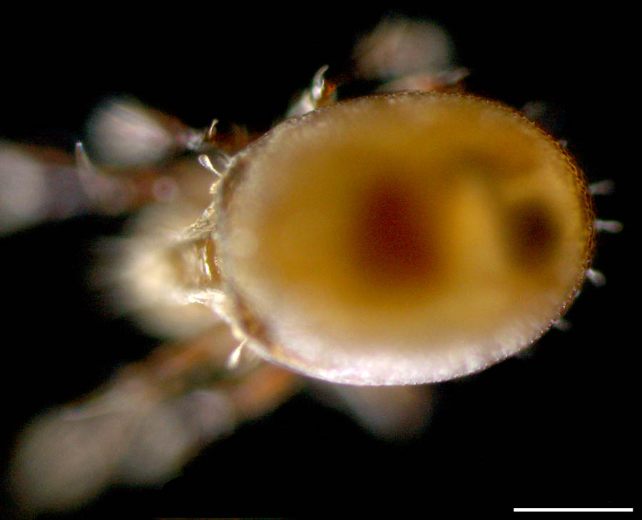 ザラタマゴダニ科(Xenillidae)の画像