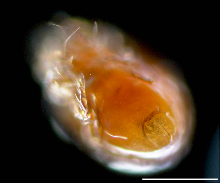 ナガコソデダニ科(Protoribatidae)の画像