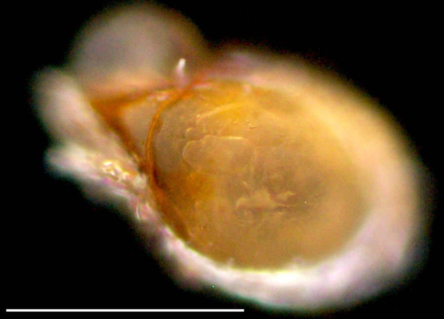 ダルマタマゴダニ科(Astegistidae)の画像