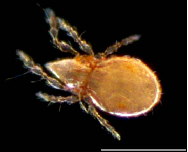 ナミツブダニ属の１種 (Oppiella sp.)