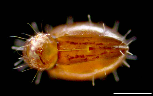 ヒメヘソイレコダニ属の1種 （Acrotritia sp.）