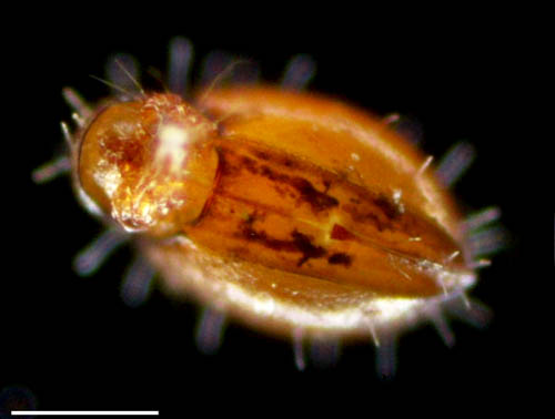 ヒメヘソイレコダニ属の1種 （Acrotritia sp.）