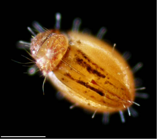 ヒメヘソイレコダニ属の1種 （Acrotritia sp.）