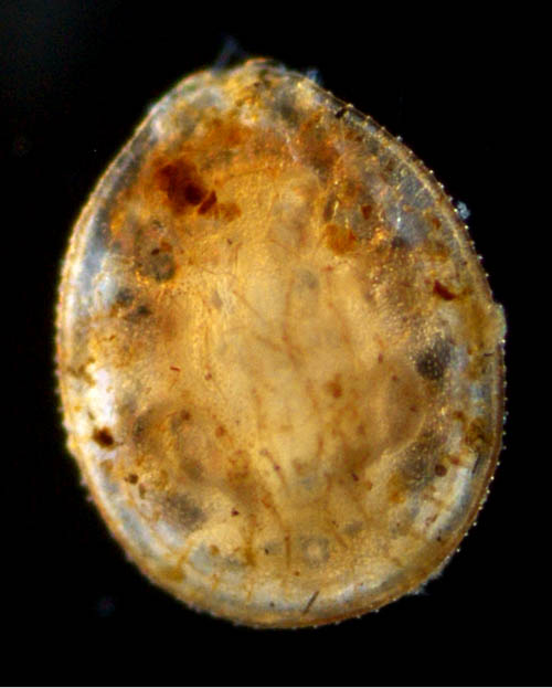 イトダニ科(Uropodidae)の画像