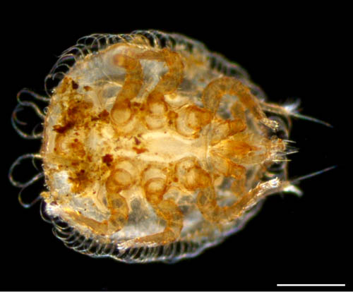 ヨゴレイトダニ（Uropoda (Phaulodinychus) pulverea）