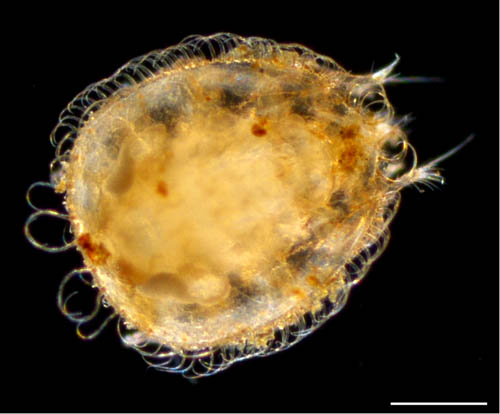 ヨゴレイトダニ（Uropoda (Phaulodinychus) pulverea）