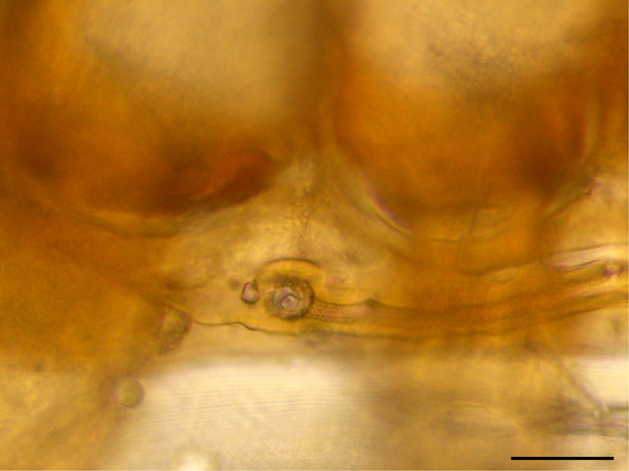 ホコダニ科(Parholaspididae)の画像