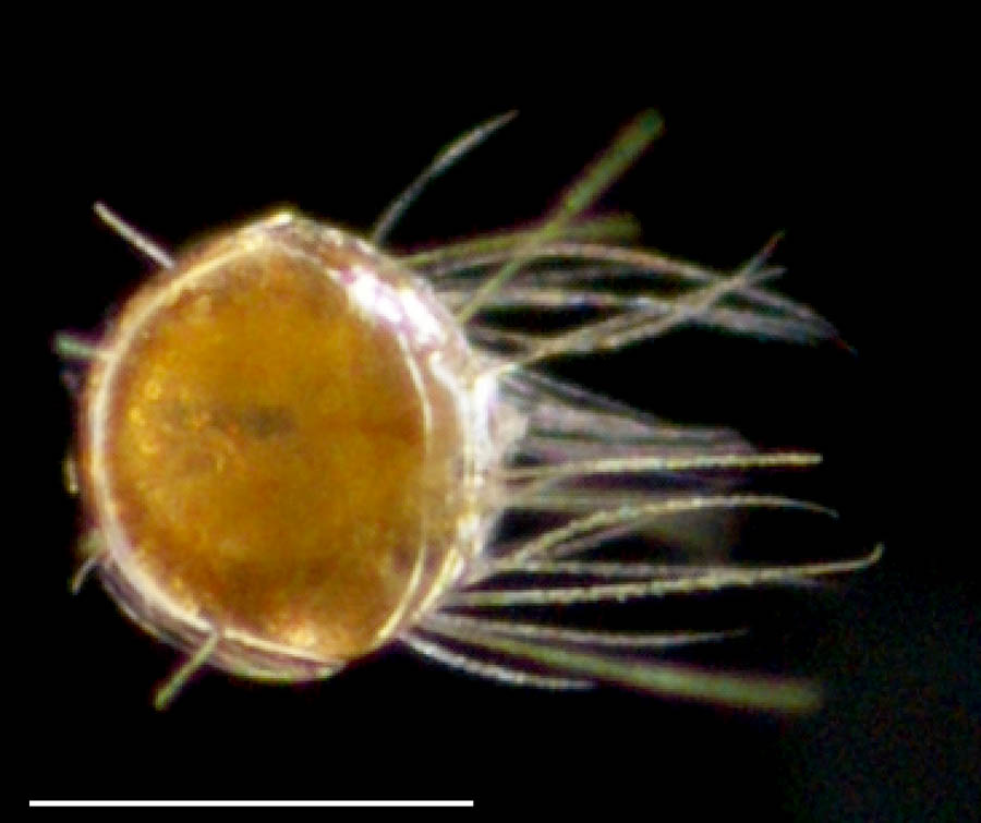 ヒサシダニ科（Scutacaridae）の画像