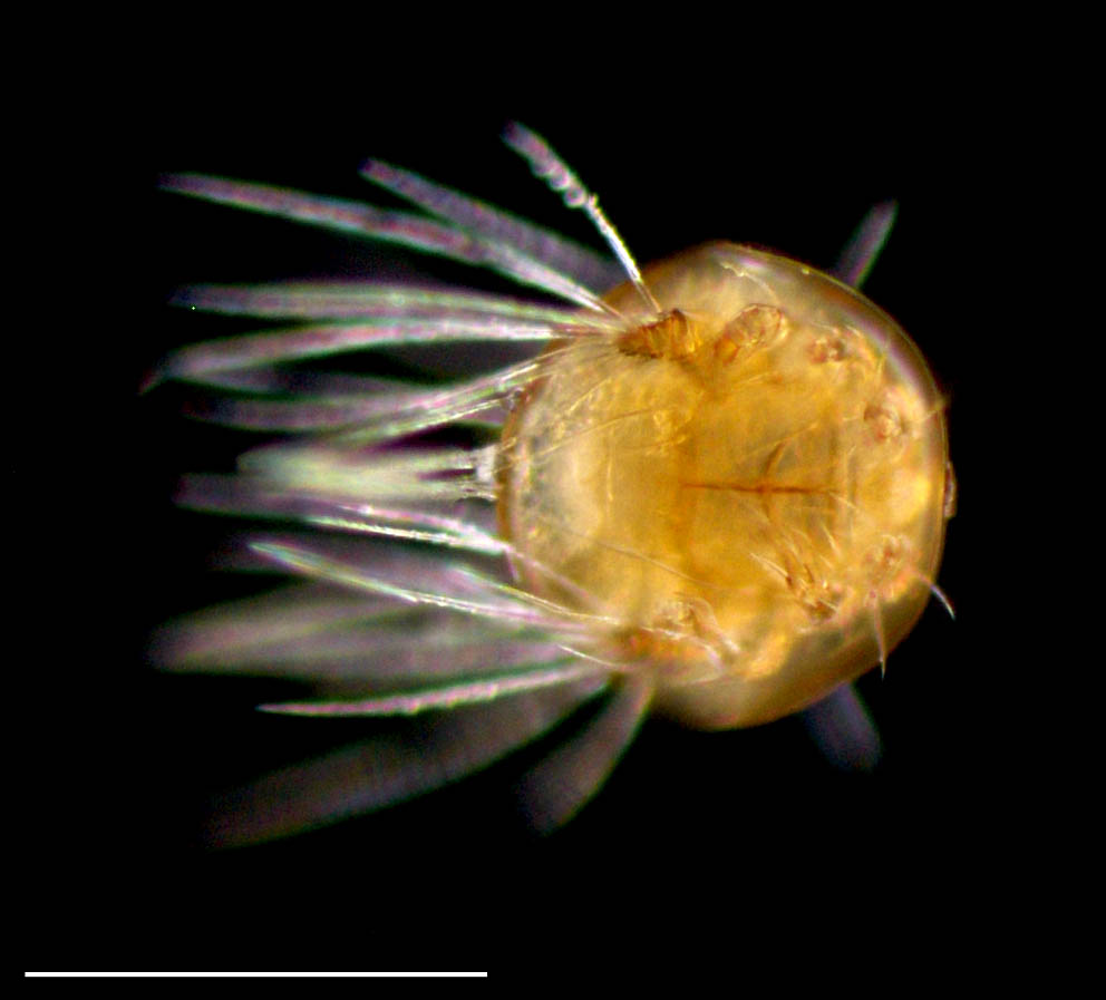 ヒサシダニ科（Scutacaridae）の画像