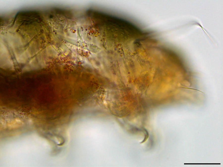 ヨロイトゲクマムシ科（Echiniscidae）の画像