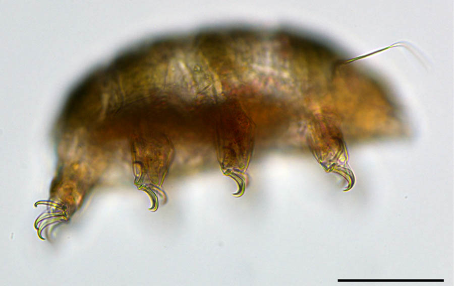 ヨロイトゲクマムシ科（Echiniscidae）の画像