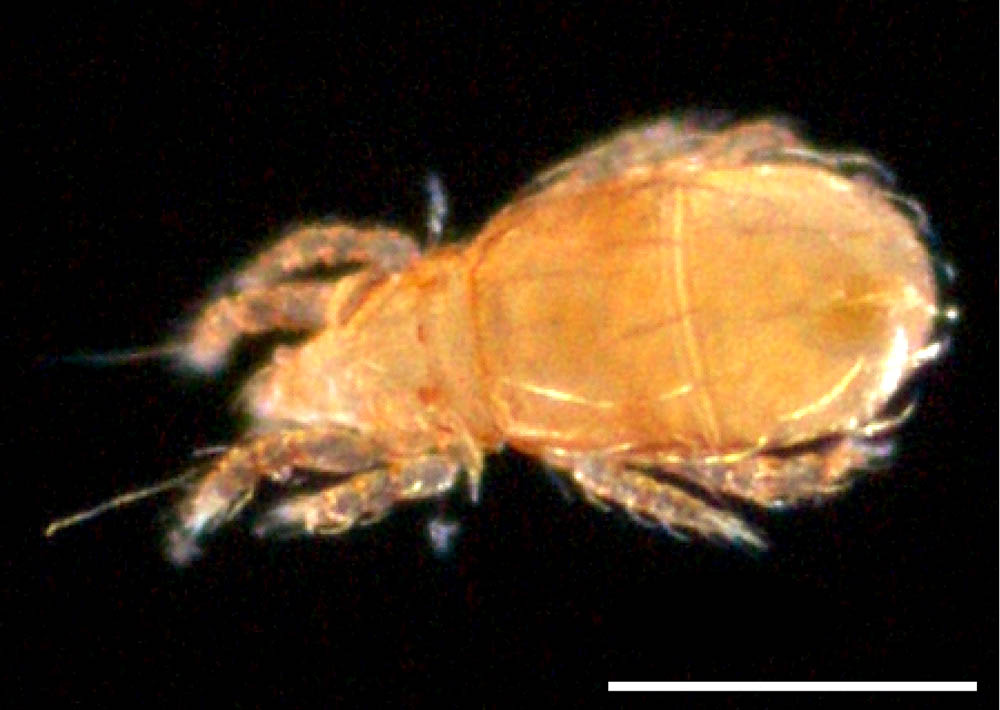 オオナガヒワダニ(Eohypochthonius magnus)の画像