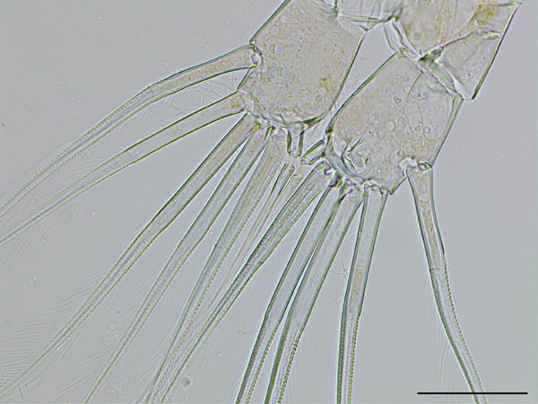 ヤマトヒゲナガケンミジンコ（Eodiaptomus japonicus）の画像