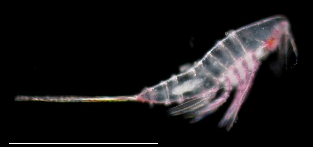 ミクロセテラ (Microsetella rosea)_の画像