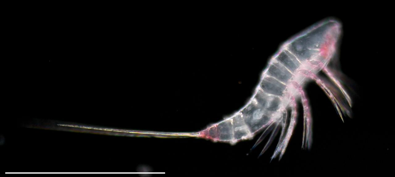 ミクロセテラ (Microsetella rosea)_の画像