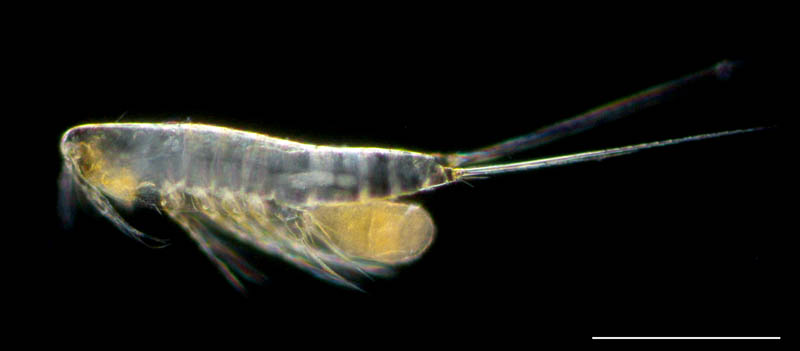 ~NZe1 (Microsetella sp.)̉摜