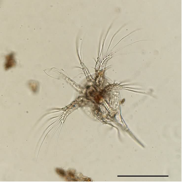 ノープリウス幼生（nauplius larva）の画像です。