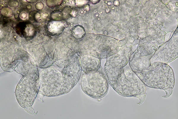 エビヤドリムシ科 (Bopyridae) の1種