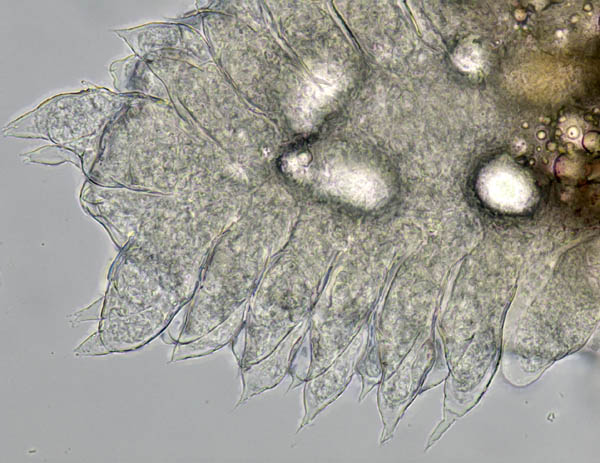 エビヤドリムシ科 (Bopyridae) の1種