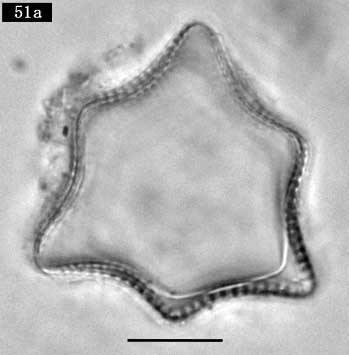 Triceratium dubium