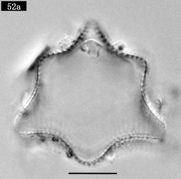 Triceratium dubium