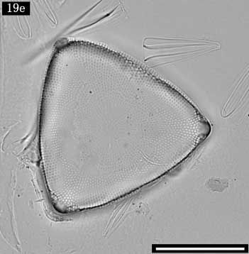 Triceratium sp.