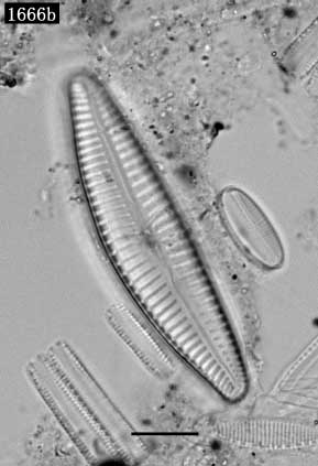 Cymbella cf. cymbiformis