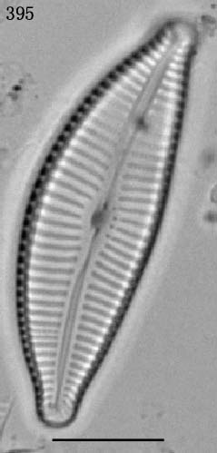 Cymbella turgidula基本種