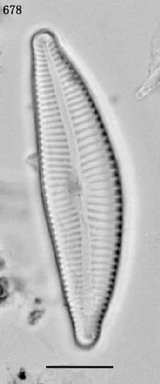 Cymbella turgidula基本種