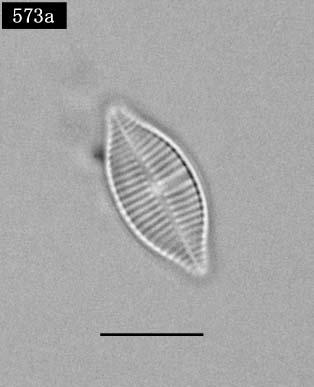 Achnanthidium delicatulum