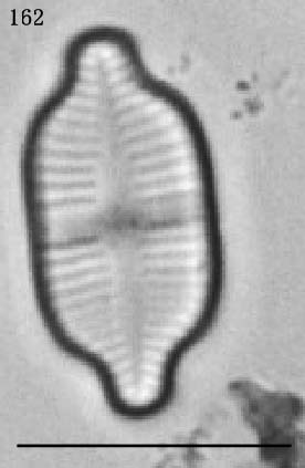Achnanthidium exiguum基本種