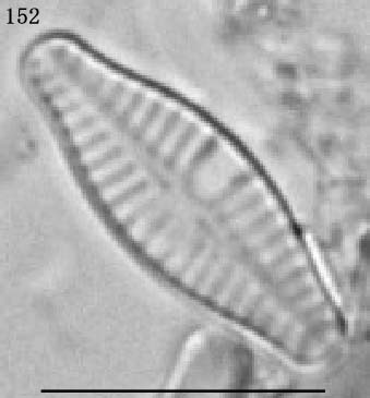 Achnanthidium lanceolatum