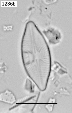 Achnanthidium cf. peragalli