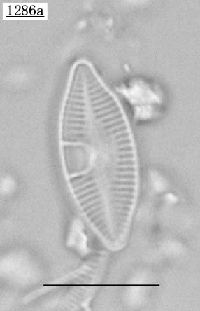 Achnanthidium cf. peragalli
