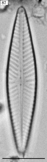 Navicula pseudolanceolata
