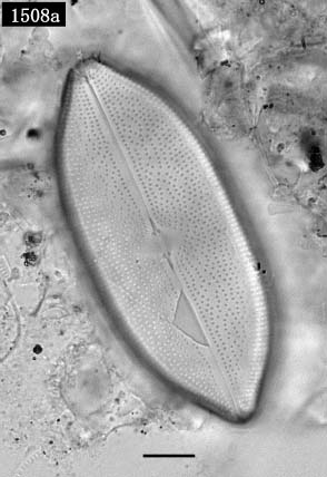 バシラリア亜綱の一種（Bacillariophycidae）