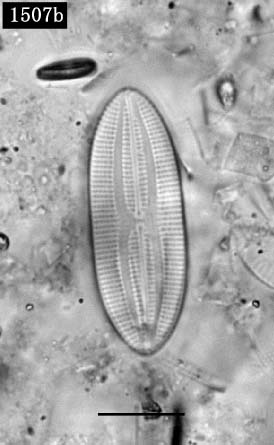 バシラリア亜綱の一種（Bacillariophycidae）