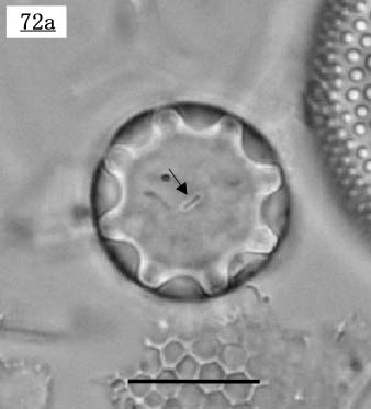 oNeAXc(Bacteriastrum sp.)