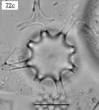 oNeAXc(Bacteriastrum sp.)