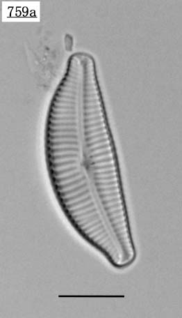 キンベラ属(Cymbella turgidula)