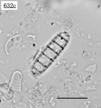 feBNvVX(Denticulopsis hyalina)
