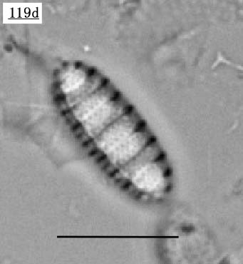 デンティクロプシス属(Denticulopsis crassa)