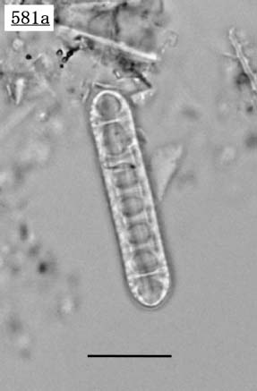 デンティクロプシス属(Denticulopsis sp.)