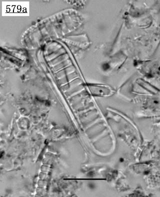 デンティクロプシス属(Denticulopsis sp.)